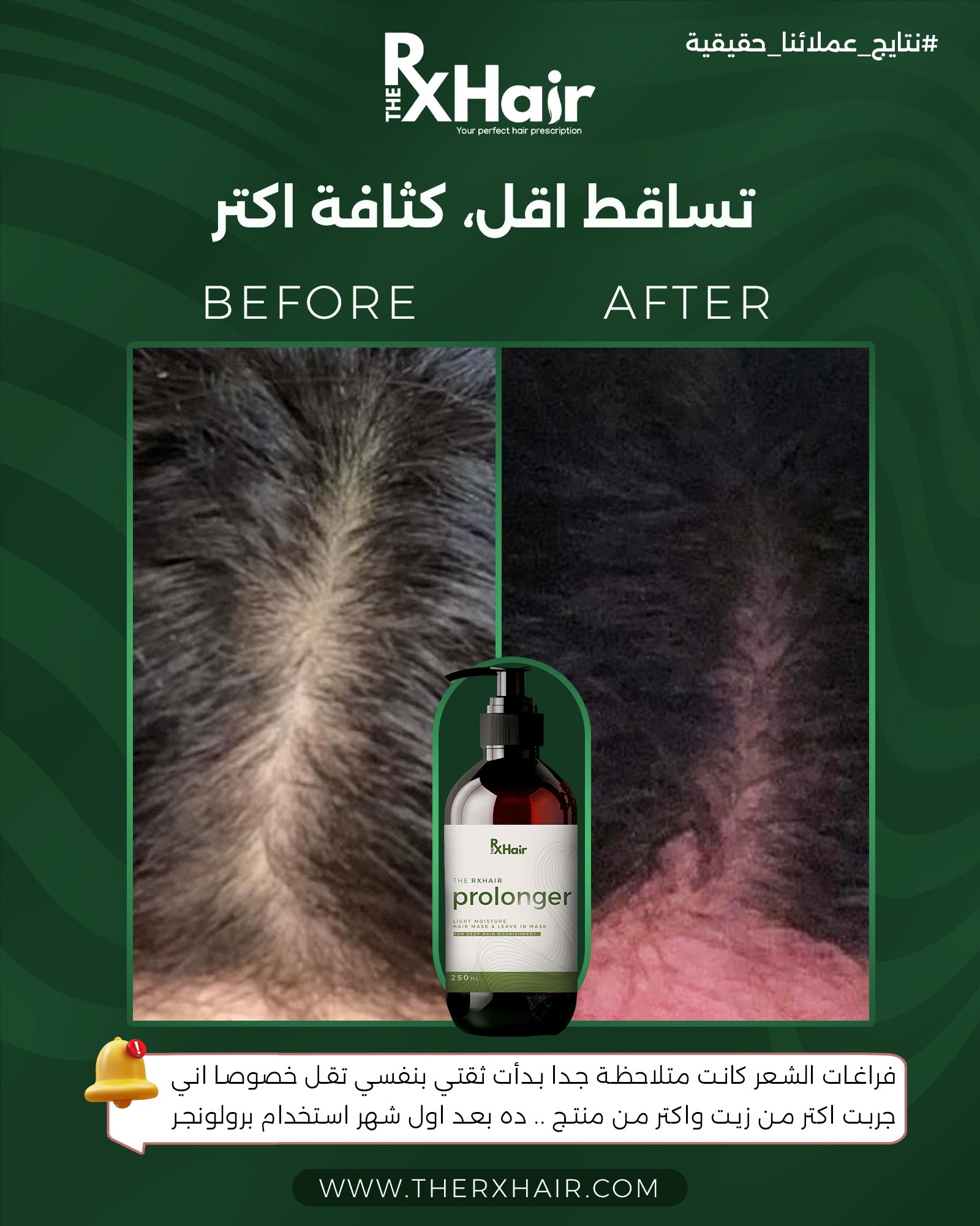 Prolonger