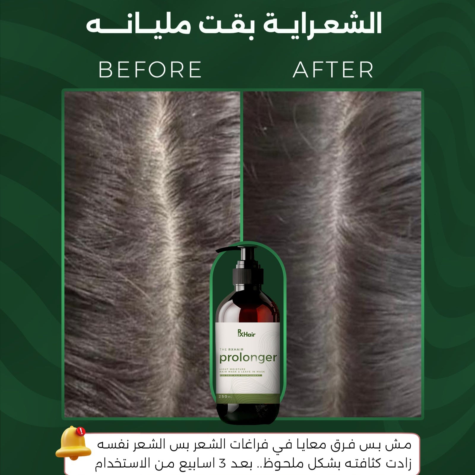 Prolonger